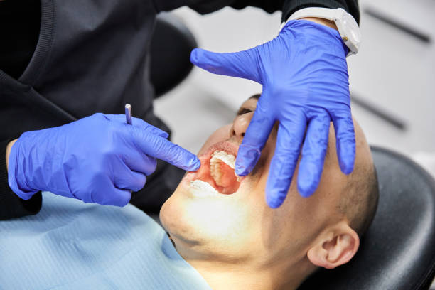 Best Chipped Tooth Repair Near Me  in London, CA